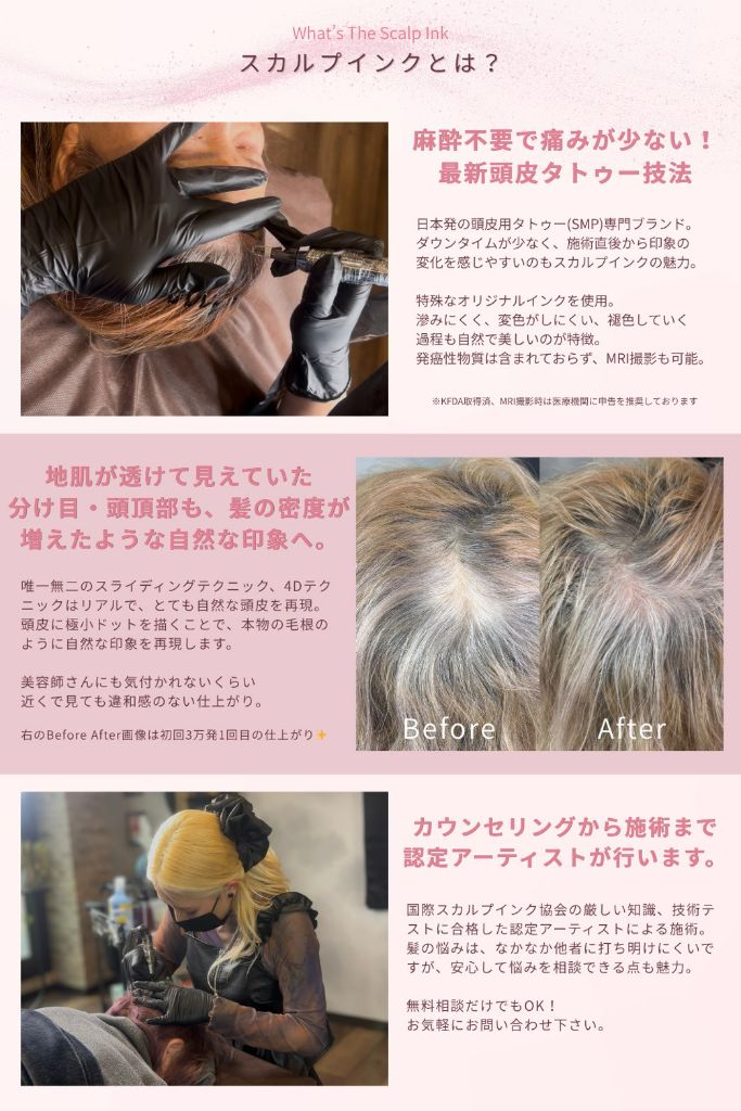 スカルプインクとは